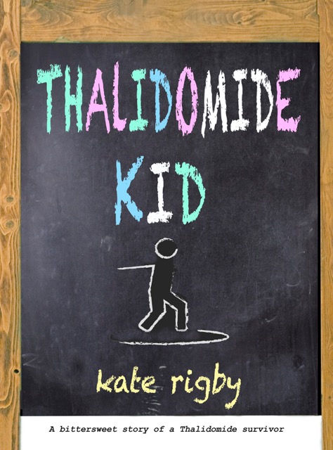 thalidomide-kid-sept-18